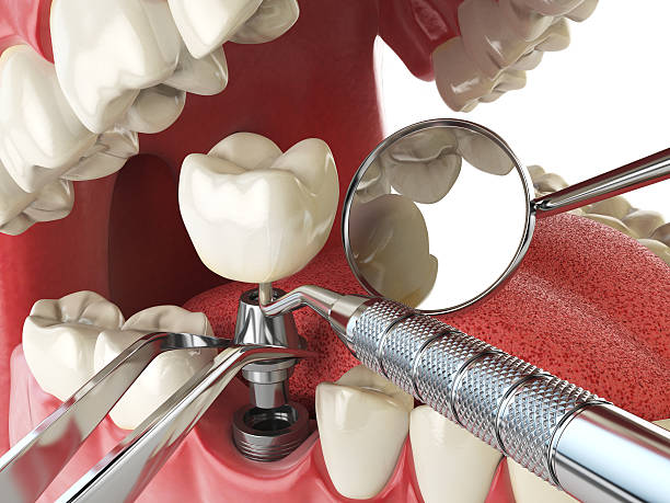 Best Emergency Treatment for Toothache in Lanham, MD